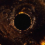 GOLD 1